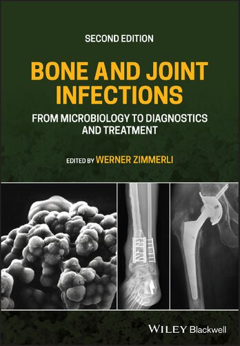 Bone and Joint Infections: From Microbiology to Diagnostics and Treatment (2nd Edition) – eBook PDF