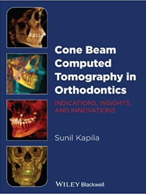 Cone Beam Computed Tomography in Orthodontics – eBook PDF