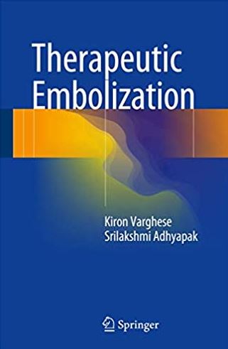 Therapeutic Embolization Kiron Varghese, ISBN-13: 978-3319424927