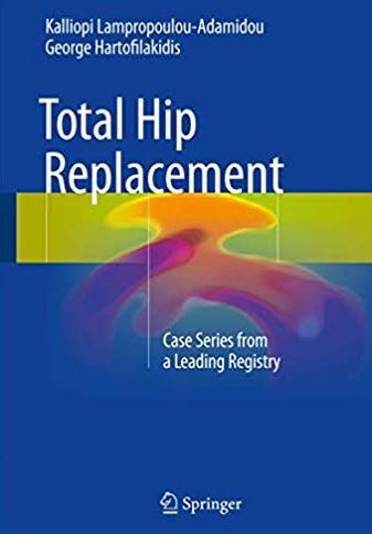 Total Hip Replacement: Case Series from a Leading Registry, ISBN-13: 978-3319533599